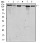 MSH6 Antibody